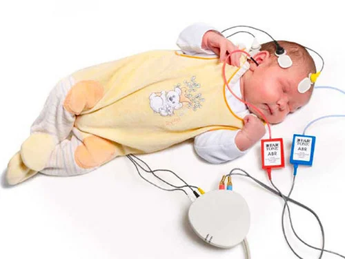 Newborn Hearing Test | Early Hearing Screening for Babies