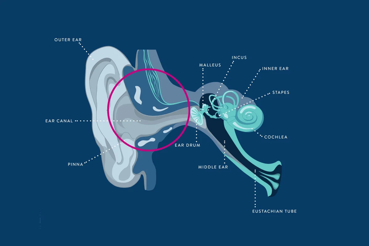 Conductive Hearing Loss Treatment